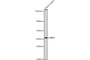 Western blot analysis of extracts of Mouse spleen, using NEIL1 antibody (ABIN6130579, ABIN6144514, ABIN6144515 and ABIN6221523) at 1:1000 dilution. (NEIL1 Antikörper  (AA 187-476))
