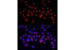 Immunofluorescence (IF) image for anti-Alanyl tRNA Synthetase (AARS) (AA 1-100) antibody (ABIN7265526)