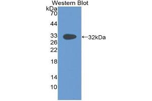Western blot analysis of the recombinant protein. (Paxillin Antikörper  (AA 201-461))