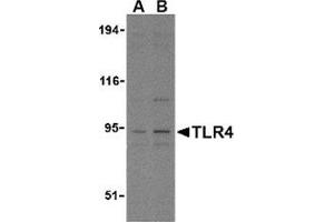 Western blot analysis of TLR4 in PC-3 cell lysates with this product at (A) 2. (TLR4 Antikörper  (N-Term))