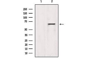 Western blot analysis of extracts from HepG2, using LGTN Antibody. (EIF2D Antikörper  (Internal Region))