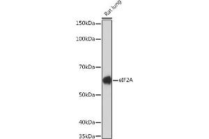 Western blot analysis of extracts of Rat lung, using eIF2A Rabbit mAb (ABIN7267035) at 1:1000 dilution. (EIF2A Antikörper)