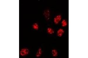 Immunofluorescent analysis of PPP3CA staining in Hela cells.