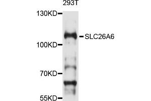 Western blot analysis of extracts of 293T cells, using SLC26A6 antibody (ABIN4905190) at 1:1000 dilution.