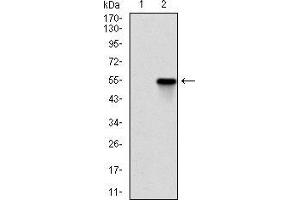 Western blot analysis using ROCK1 mAb against HEK293 (1) and ROCK1 (AA: 403-610)-hIgGFc transfected HEK293 (2) cell lysate. (ROCK1 Antikörper)