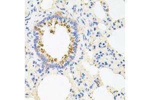 Immunohistochemistry of paraffin-embedded rat lung using NCR3 antibody (ABIN5974302) at dilution of 1/100 (40x lens). (NCR3 Antikörper)