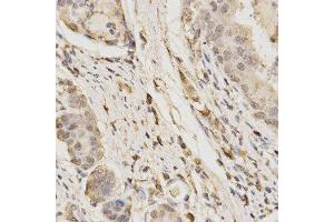 Immunohistochemistry (IHC) image for anti-Galactosidase, beta 1 (GLB1) (AA 1-270) antibody (ABIN3015643)