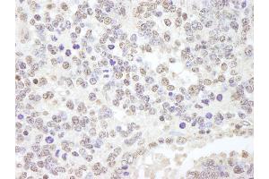 anti-Ubiquitin Specific Peptidase 47 (USP47) (C-Term) antibody