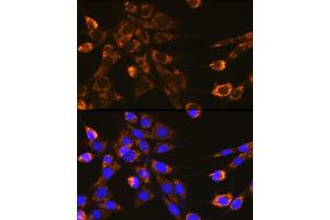 Immunofluorescence analysis of NIH-3T3 cells using Integrin-β1/CD29 Rabbit pAb (ABIN6134032, ABIN6142578, ABIN6142579 and ABIN6219452) at dilution of 1:100 (40x lens). (ITGB1 Antikörper  (AA 600-700))