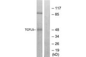 Western blot analysis of extracts from RAW264. (TCFL5 Antikörper  (AA 311-360))