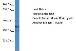 Host: Rabbit Target Name: Jph4 Sample Type: Mouse Brain lysates Antibody Dilution: 1. (Junctophilin 4 Antikörper  (Middle Region))