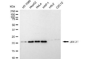 anti-Ubiquitin-Conjugating Enzyme E2T (Ube2t) antibody