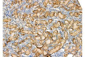 ABIN6265698 and ABIN6277586 at 1/100 staining Rat kidney tissue by IHC-P. (TPT1 Antikörper  (Internal Region))