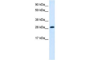 Human heart; WB Suggested Anti-ABT1 Antibody Titration: 1. (Activator of Basal Transcription 1 Antikörper  (Middle Region))