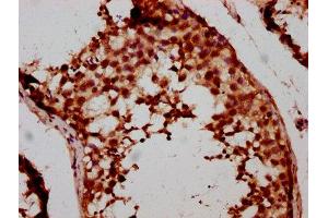 IHC image of ABIN7152883 diluted at 1:500 and staining in paraffin-embedded human testis tissue performed on a Leica BondTM system. (FSD1 Antikörper  (AA 251-370))