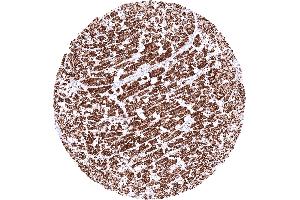 Heart muscle exhibiting a strong granular cytoplasmic SDHA staining (Rekombinanter SDHA Antikörper  (N-Term))