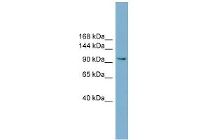 WB Suggested Anti-NCAM2 Antibody Titration:  0. (NCAM2 Antikörper  (Middle Region))