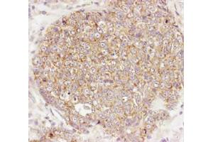 Immunohistochemistry. (AKT1 Antikörper  (C-Term))