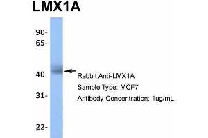 Host: Rabbit  Target Name: LMX1A  Sample Tissue: MCF7  Antibody Dilution: 1. (LMX1A Antikörper  (Middle Region))