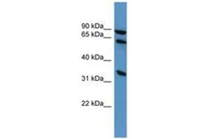 Image no. 1 for anti-Engulfment and Cell Motility 1 (ELMO1) (AA 372-421) antibody (ABIN6746630) (ELMO1 Antikörper  (AA 372-421))