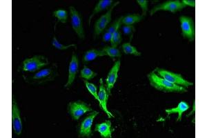 Immunofluorescent analysis of Hela cells using ABIN7171536 at dilution of 1:100 and Alexa Fluor 488-congugated AffiniPure Goat Anti-Rabbit IgG(H+L) (TAS2R13 Antikörper  (AA 150-184))