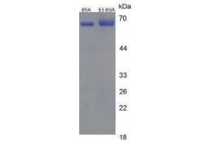 Image no. 1 for Estriol (E3) protein (BSA) (ABIN1880184)