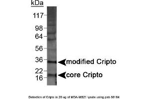 Image no. 1 for anti-Teratocarcinoma-Derived Growth Factor 1 (TDGF1) (N-Term) antibody (ABIN363493) (TDGF1 Antikörper  (N-Term))