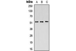 Western blot analysis of PICK1 expression in HEK293T (A), Raw264. (PICK1 Antikörper  (C-Term))
