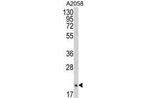 Western blot analysis of FTH1 Antibody (C-term) in A2058 cell line lysates (35 µg/lane). (FTH1 Antikörper  (C-Term, Heavy Chain))