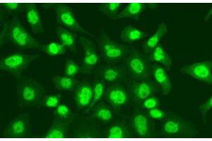 Immunofluorescence analysis of A549 cells using LIG1 Polyclonal Antibody (LIG1 Antikörper)