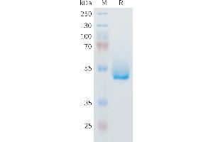 SDS-PAGE (SDS) image for Interleukin 6 (IL6) (AA 25-211) protein (Fc Tag) (ABIN7538346)