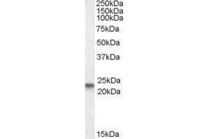Western Blotting (WB) image for Caveolin 3 (CAV3) peptide (ABIN370342)
