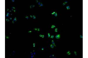 Immunofluorescence staining of Hela cells with ABIN7139968 at 1:100, counter-stained with DAPI. (OR1K1 Antikörper  (AA 261-273))