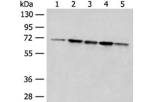 Western blot analysis of 293T cell Rat liver tissue A172 and Jurkat cell lysates using ACSF2 Polyclonal Antibody at dilution of 1:400 (ACSF2 Antikörper)