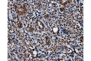 Immunohistochemistry (IHC) image for anti-Induced Myeloid Leukemia Cell Differentiation Protein Mcl-1 (MCL1) antibody (ABIN1499339) (MCL-1 Antikörper)