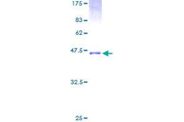 NPPA Protein (AA 1-153) (GST tag)