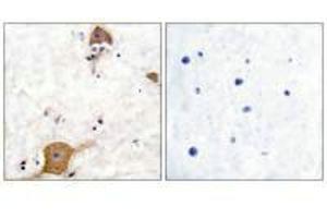 Immunohistochemical analysis of paraffin-embedded human brain tissue using NRG1 isoform-10 antibody. (Neuregulin 1 Antikörper  (Isoform 10))