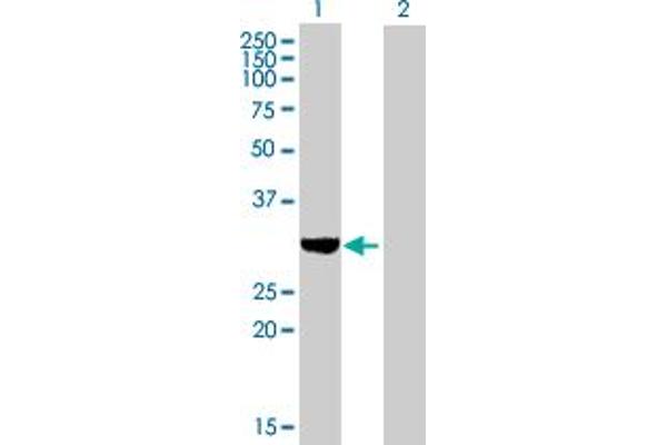 SULT1C2 antibody  (AA 1-296)