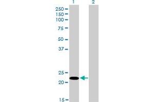 Western Blot analysis of FUSIP1 expression in transfected 293T cell line by FUSIP1 monoclonal antibody (M03), clone 1A6.