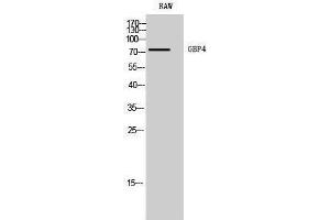 Western Blotting (WB) image for anti-Guanylate Binding Protein 4 (GBP4) (C-Term) antibody (ABIN3184759) (GBP4 Antikörper  (C-Term))