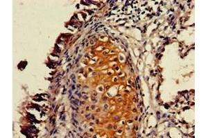 Immunohistochemistry of paraffin-embedded human lung tissue using ABIN7162445 at dilution of 1:100