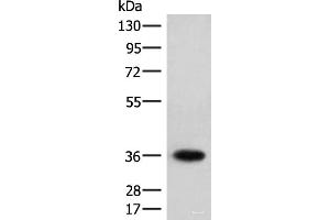 Western blot analysis of Jurkat cell lysate using HOXC12 Polyclonal Antibody at dilution of 1:500 (HOXC12 Antikörper)