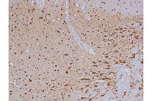 ABIN6267324 at 1/200 staining Rat brain tissue sections by IHC-P. (Tyrosine Hydroxylase Antikörper  (pSer19))