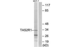 Western Blotting (WB) image for anti-Taste Receptor, Type 2, Member 1 (TAS2R1) (AA 6-55) antibody (ABIN2891095) (TAS2R1 Antikörper  (AA 6-55))