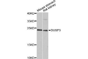 Western blot analysis of extracts of various cell lines, using DUSP3 antibody (ABIN6290308) at 1:3000 dilution. (Dual Specificity Phosphatase 3 (DUSP3) Antikörper)