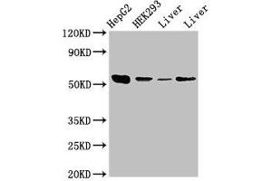 Western Blot Positive WB detected in: HepG2 whole cell lysate, HEK293 whole cell lysate, Rat liver tissue, Mouse liver tissue All lanes: MAP2K5 antibody at 3. (MAP2K5 Antikörper  (AA 1-190))