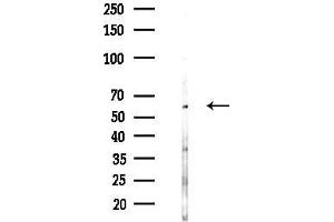 Western blot analysis of lysates from COLO205 cells(UV,30 min treatment), using ATL3 Antibody at 1/1000 dilution.