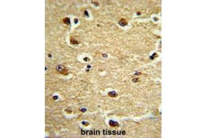 Formalin-fixed and paraffin-embedded human brain tissue reacted with CROT Antibody (N-term), which was peroxidase-conjugated to the secondary antibody, followed by DAB staining. (CROT Antikörper  (N-Term))