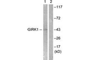 Western Blotting (WB) image for anti-Potassium Inwardly-Rectifying Channel, Subfamily J, Member 3 (KCNJ3) (AA 151-200) antibody (ABIN2888872) (KCNJ3 Antikörper  (AA 151-200))