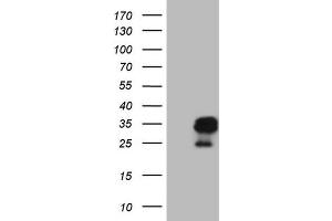 Western Blotting (WB) image for anti-Amelotin (AMTN) antibody (ABIN2716039)
